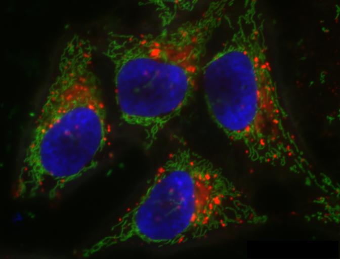 HeLa cells image